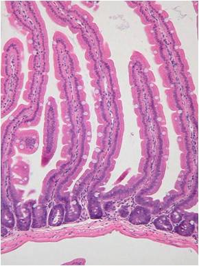 腸管ロール
