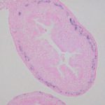 MP-A-012_Ascl1_E17.5腸管