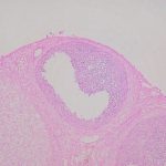 PV-m卵巣 Bmpr1b-2
