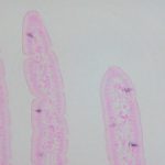 Tph1-1 8w-小腸