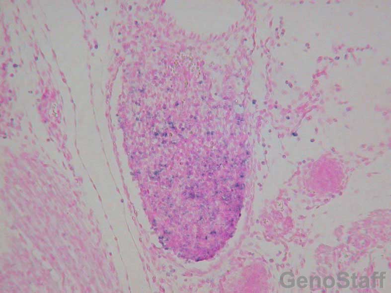 E18.5