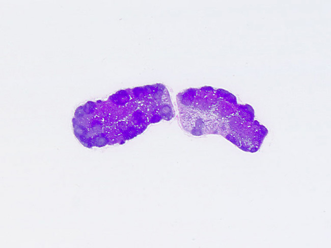 腸間膜リンパ節