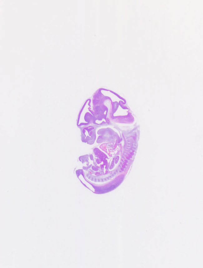 E11.5d